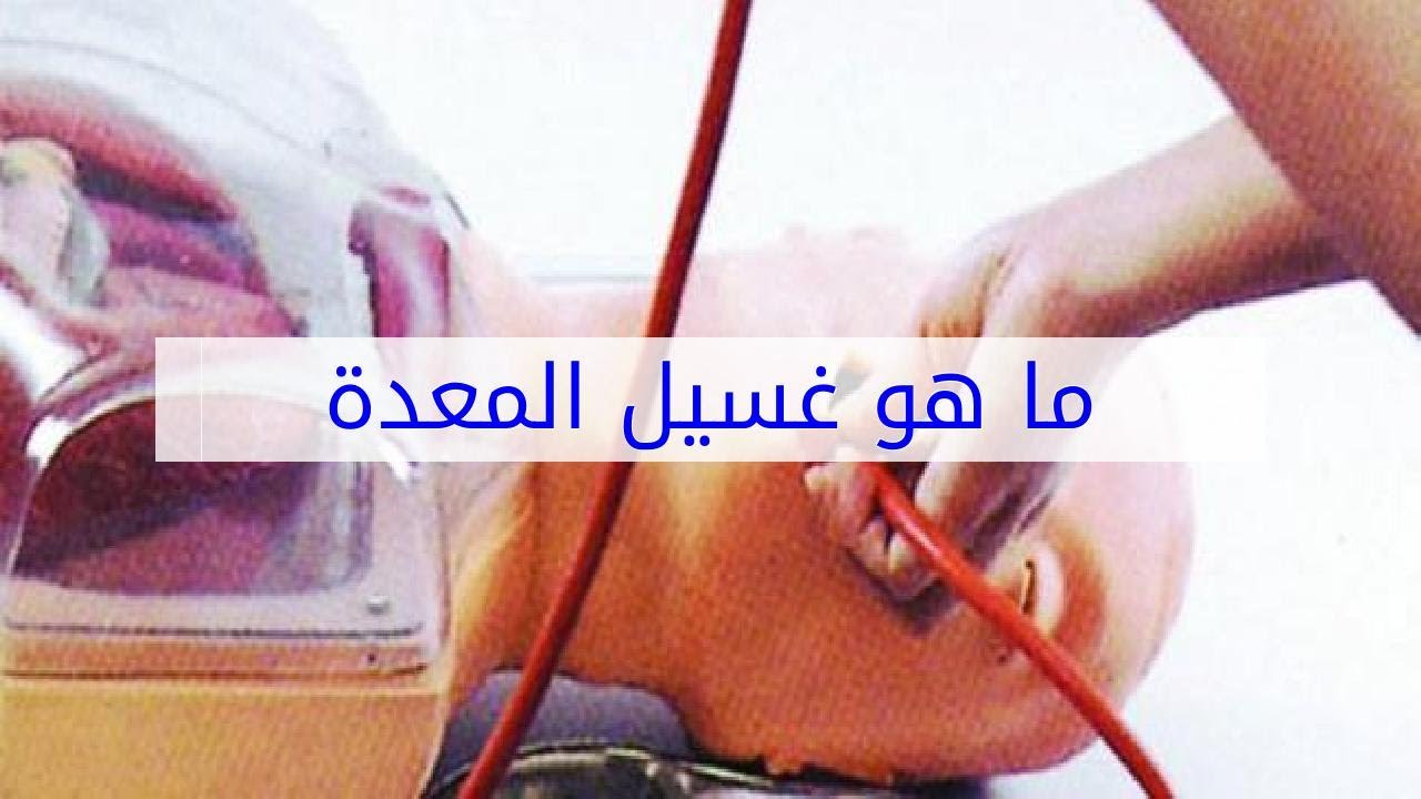 عملية غسيل المعدة - تعرف ع خطوات عمليه غسيل المعده 13101 2