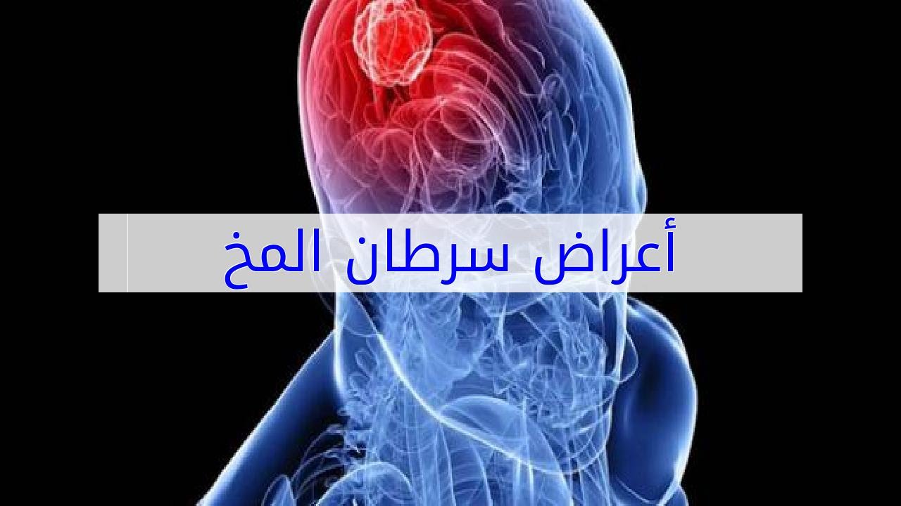 اعراض سرطان الدماغ , الاصابة بمرض اورام الدماغ واعراضه