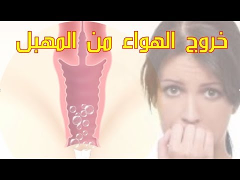 خروج ريح من المهبل 12364 2