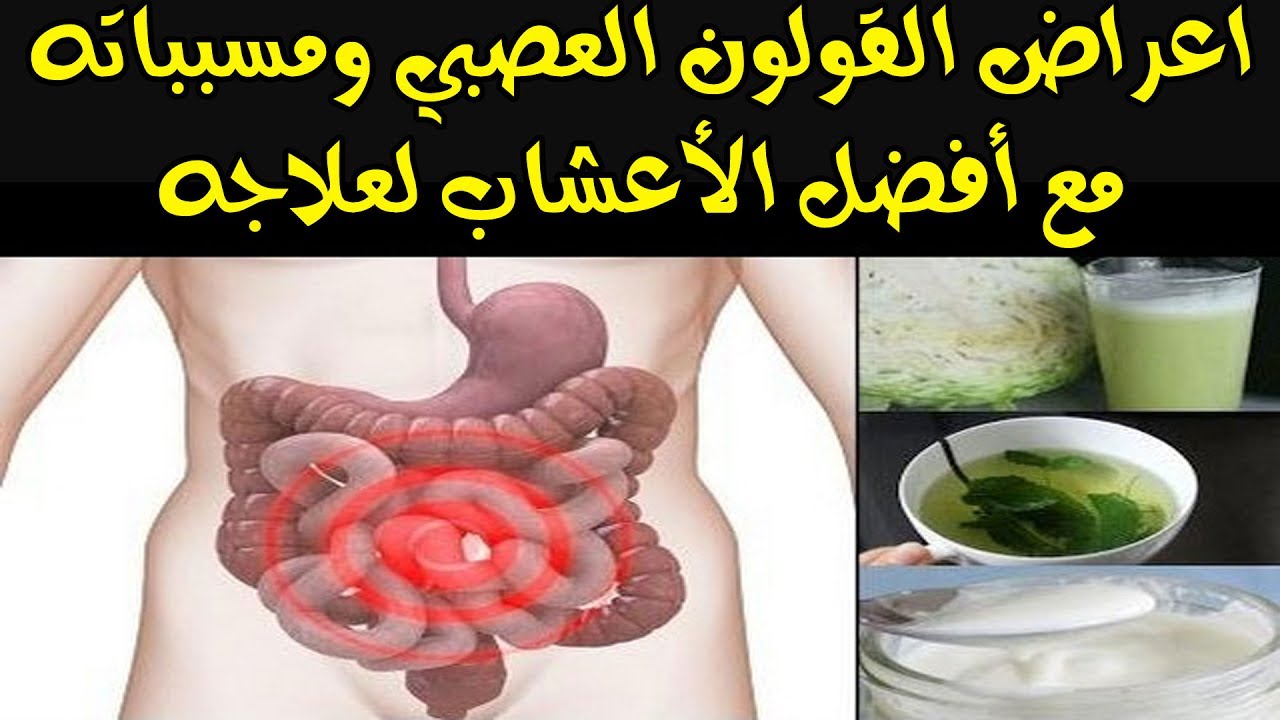 مرض القولون - ماهى اعراض مرض القولون 3456 4