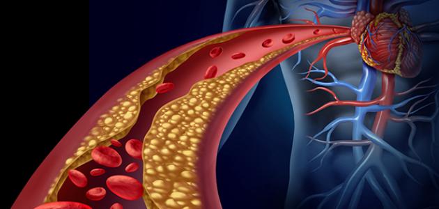 معدل الكوليسترول الطبيعي - تعالو اعرفوا النسبه التى يحتاجها الجسم من الكوليسترول 13078 2