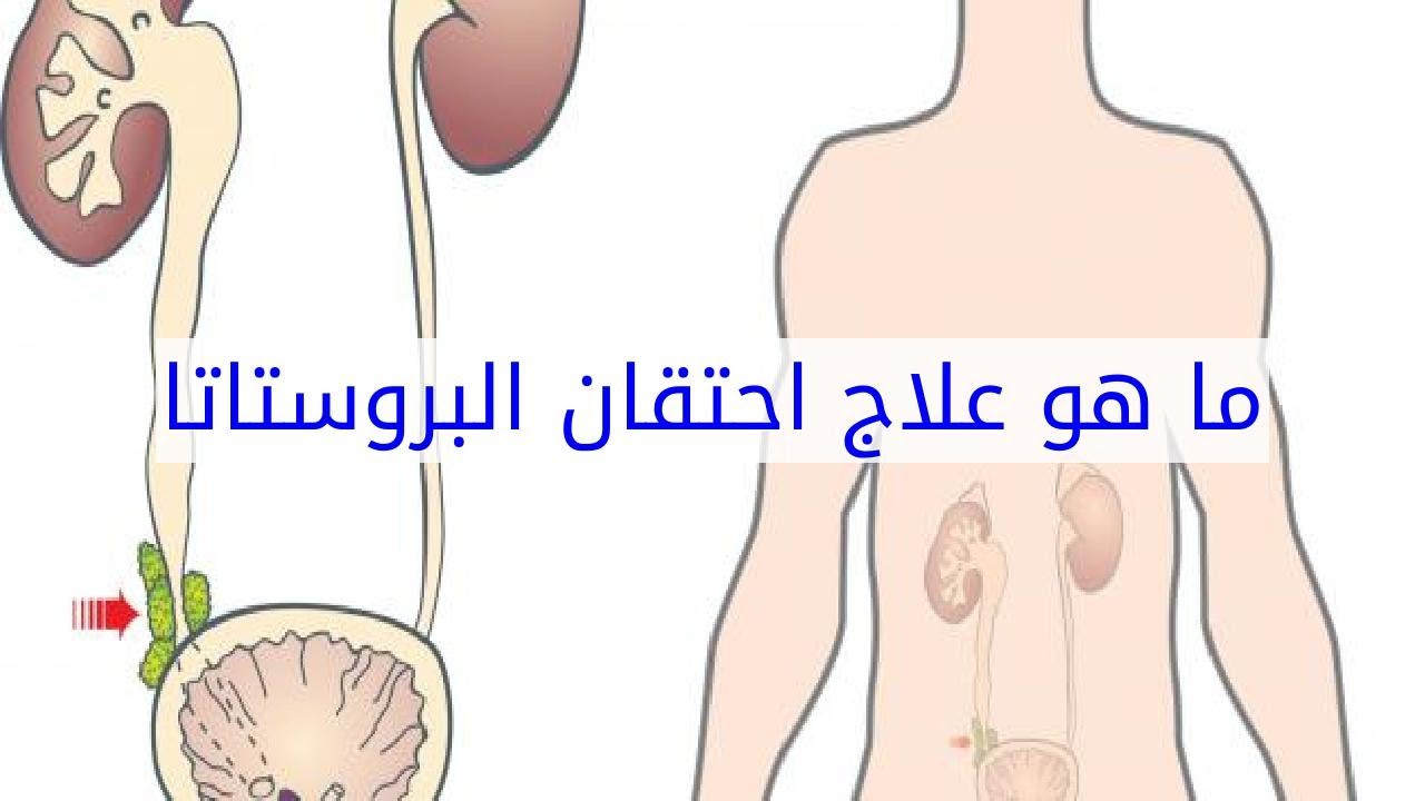 علاج تضخم البروستاتا , كيف يمكن معالجة تضخم البروستاتا