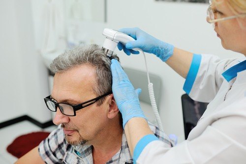 زراعة الشعر بالليزر - معلومات ضرورية جدا يجب معرفتها عند عمل الليزر 13463