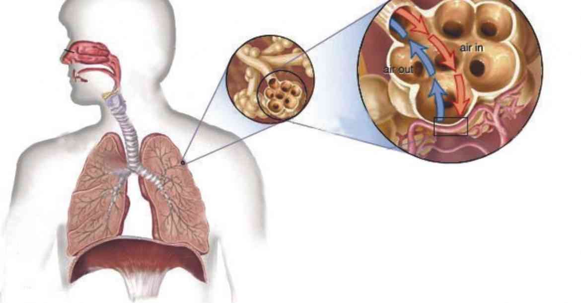 علاج مرض السل - طرق الشفاء من مرض السل 951 2