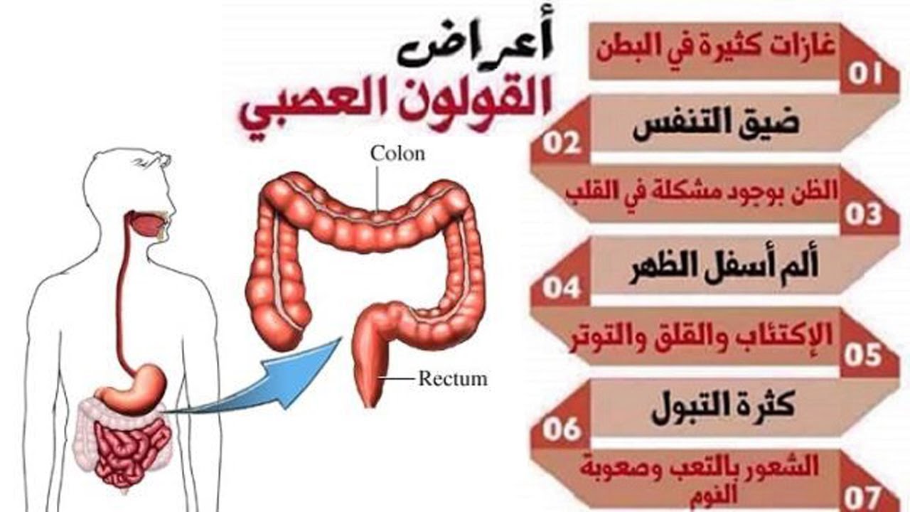 مرض القولون - ماهى اعراض مرض القولون 3456 2