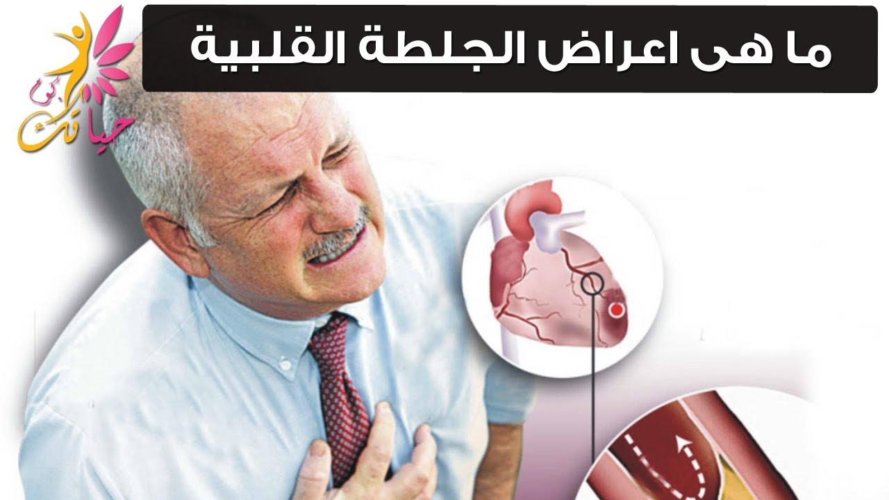 اعراض الجلطة - مظاهر الاصابة بالجلطة