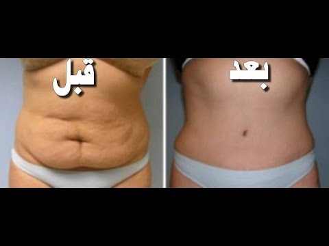 كيف تتخلص من الكرش - نصائح لتخسيس منطقه البطن 1308