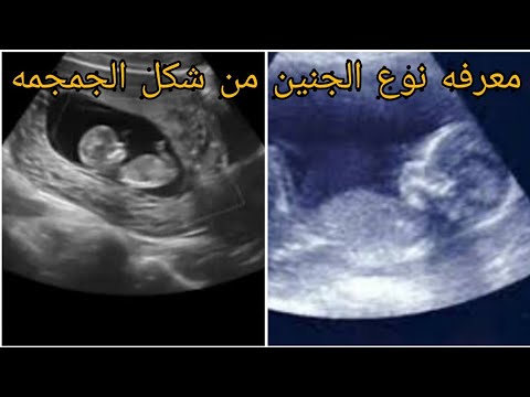 متى اعرف نوع الجنين - تعالو اعرفوا المعاد المناسب عشان تعرفي حامل ف بنت ولا ولد 13194