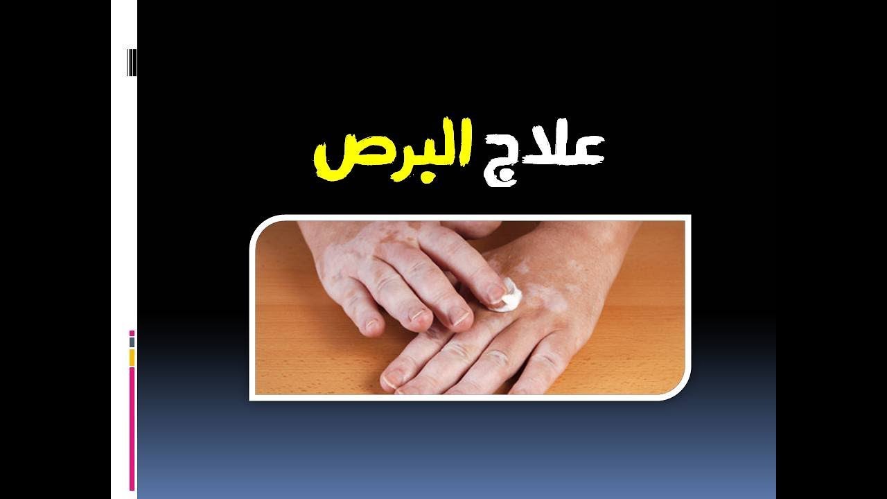 علاج البرص - ماهى الاسباب التي تؤدي الى حدوث مرض البهاق 6556 12