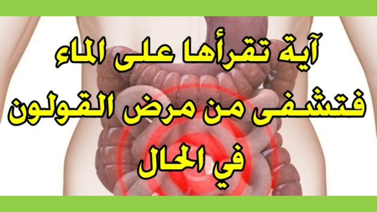 مرض القولون - ماهى اعراض مرض القولون 3456 1