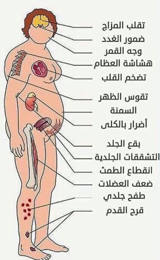 اضرار الكورتيزون - الكورتيزون وتاثيره علي جسم الانسان 2298 5