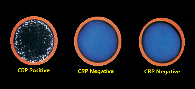 تحليل Crp للحامل - اهميه تحليل Crp للمراة الحامل 13047