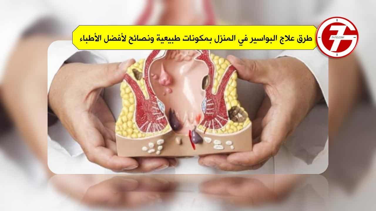 علاج البواسير - ماهى طرق علاج البواسير 3167 2