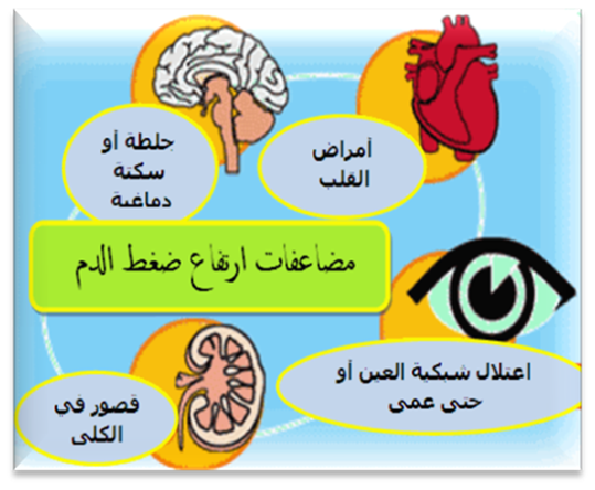 اعراض ارتفاع الضغط - ادرك ضغطك وعالجه 6327