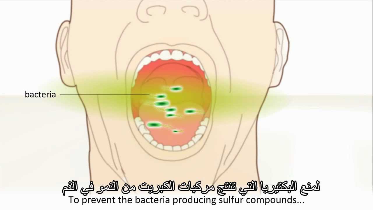 علاج رائحة الفم الكريهة - اذا كنت تعاني من رائحة كريهة بالفم ماذا تفعل 3410 3