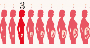 12651 2 صداع الحامل في الشهر الثالث , أعراض صداع الحمل U19